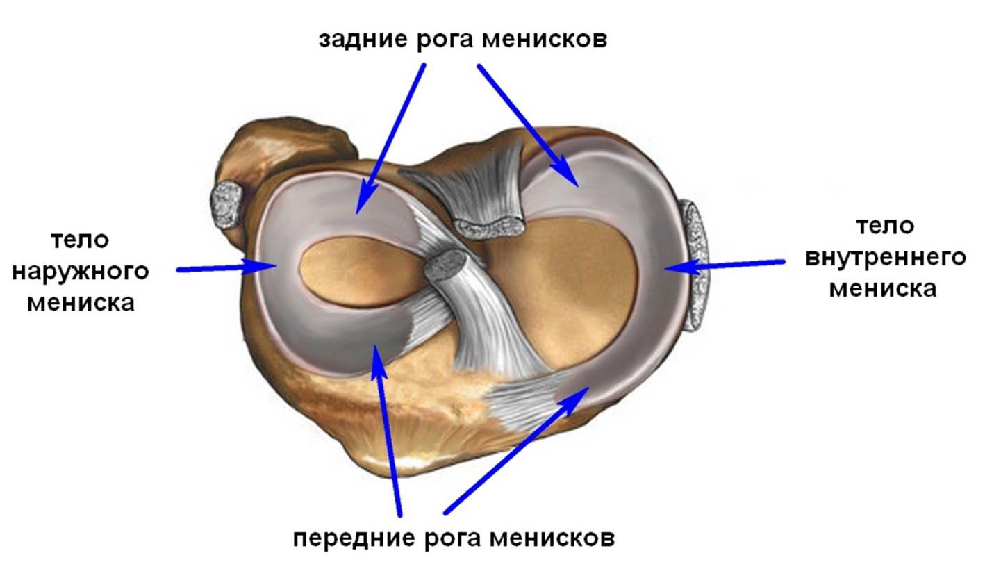 Разрыв медиальной. Медиальный мениск коленного сустава анатомия. Внутренний мениск коленного сустава анатомия. Повреждение переднего рога латерального мениска. Строение колена повреждение мениска.