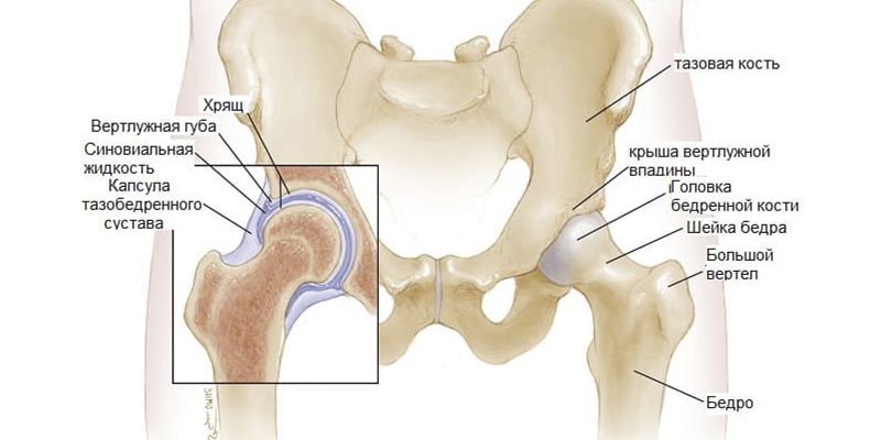 Фемороацетабулярный импинджмент синдром тазобедренного сустава что это такое
