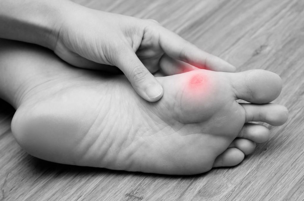 Косточка на ноге: 7 не эффективных народных методов для лечения дома